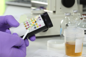 MPU-Vorbereitung: Drogen und Alkohol dürfen z.B. nicht in Ihrem Urin nachgewiesen werden. Die Tests dafür sind gebührenpflichtig.